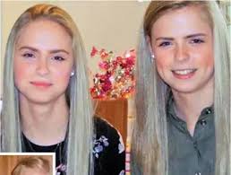 Twin with sepsis died ... after she took NHS advice to avoid A&E