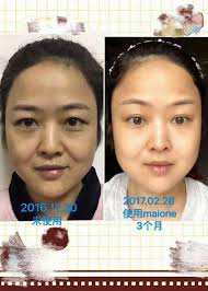 👑👑一瓶漫妮MAIONE青春定格原液！ 🌹相当于做4次皮肤透析； 🌹相当于在美容院做30次专业护理; 🌹相当于做3个周期的美白淡斑护理;  🌹相当于做3个周期专业挺拔乳房！ 💗💗💗不打针不开刀喷一喷就可以做到微整形的效果，产品效果是印证出来的，全球独一无二的产品，你值得 ...