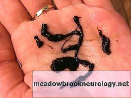 A menstruação representa os anos férteis da vida da mulher. Cauze Ale Sangelui Intunecat È™i DescÄƒrcare Maro In Timpul MenstruaÈ›iei SÄƒnÄƒtate 2021