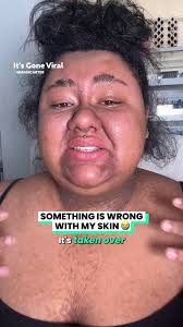 No one knows why my skin is like this...