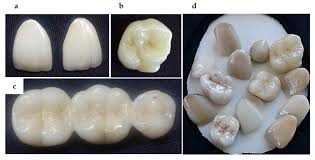 Biomimetic Aspects of Restorative Dentistry Biomaterials