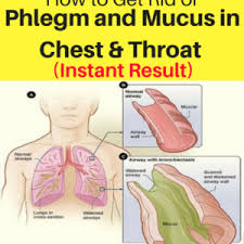 Pin On Health