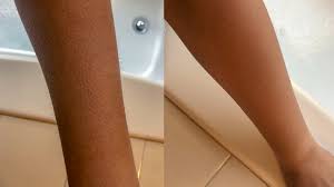 shaving arms pros cons side effects