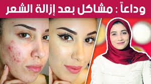 علاج حبوب الوجه وإلتهاب البشرة بعد إزالة الشعر نهائيا مرة واحد فقط Youtube