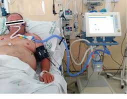 Image result for Moderate Flow Oxygen