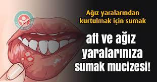 Aft Ve Agiz Yarasina Sumak Mucizesi Saglik Saglikli Tarifler Saglikli