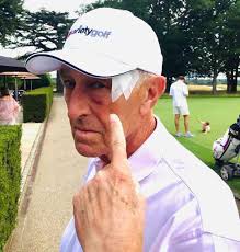 Dancing with the Stars Judge Len Goodman Had Skin Cancer Removed