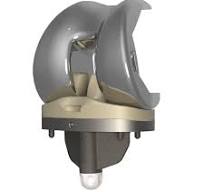 Klassic® Knee System | TJO - Total Joint Orthopedics