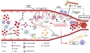 Image result for Systemic Corticosteroid