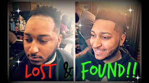 DWAYNE GOT HIS HAIRLINE RESURRECTED!!!
