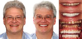 It's time to celebrate! Today is our wonderful dental hygienist Kristin's  birthday! We hope you'll join us in wishing her all the best today and in  the year ahead. Happy Birthday, Kristin!