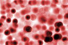 Red blood cells are round with a flattish, indented center, like doughnuts diseases of the red blood cells include many types of anemia. Red Blood Cells Large And Small Fleet Science Center San Diego Ca