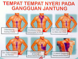 Masalah angin banyak dalam badan dan susah nak keluar? Sakit Macam Gastrik Tapi Kena Sakit Jantung Islam Itu Indah