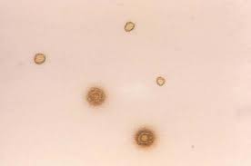 Image result for Mycoplasma