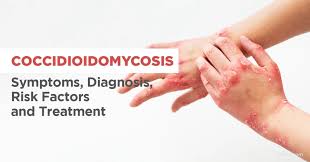 Image result for penis mycosis symptoms