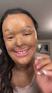 Que Le Pasó A Stacy Marquez En Su Rostro