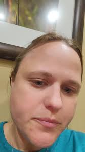 Esophageal Manometry Experience: A Struggle