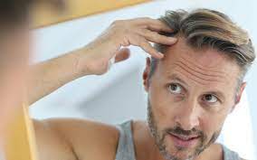 And that's how i came to know that once you start to look­, there are solutions in so many corners of your world. Hair Loss Treatment Leeds Prp Medifine Skin Clinic