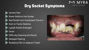 Image result for Dry Socket