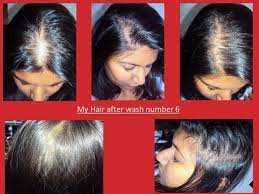 The 3ds of thinning hair… and what they mean density: Nioxin Nioxin Hair System Kit 2 Noticeably Thinning Hair Review Beauty Bulletin Treatments Masks
