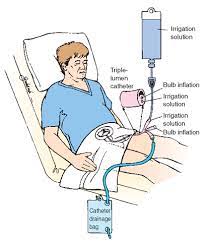 Male Reproductive Disorders Adult Care Nursing Part 3
