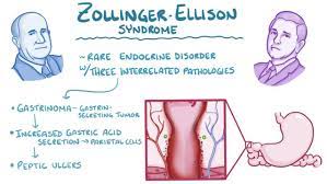 Zollinger Ellison Syndrome Osmosis