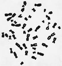 Check spelling or type a new query. Hypotonic Solution An Overview Sciencedirect Topics
