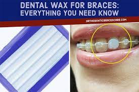 When do i take it off. What Is Braces Wax And How To Use It Orthodontic Braces Care