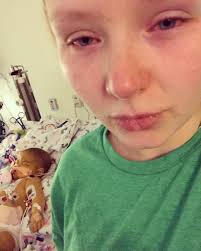 Ellie Bean, Surviving Biliary Atresia