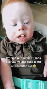 Funny Toddler Moment with Buck Teeth