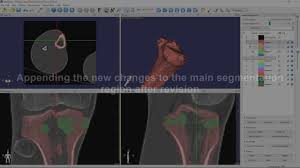 3dimviewer 3 X Tutorial Bone Segmentation From A Ct Scan And 3d Model C Segmentation Ct Scan Tutorial