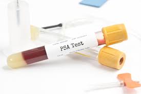 An Abnormal Psa Result What Comes Next University Health