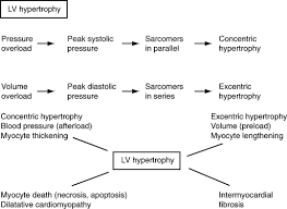 Congestive kidney in heart failure osmotic concentration of urine is. Left Ventricular Hypertrophy In Renal Failure Kidney International