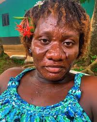 Nothing humbled like pregnancy. During pregnancy Vs Before Pregnancy.