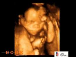 Tu bebé esta semana se ve como un recién nacido, pero en miniatura. Ecografia 4d El Bebe Con 22 Semanas De Gestacion Youtube