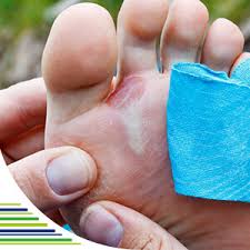 Image result for Akutní zánět nehtového lůžka