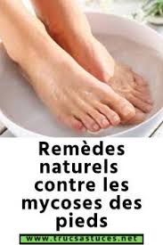 Remedes Naturels Contre Les Mycoses Des Pieds En 2020 Mycose Pied Mycose Mycose Ongle Pied