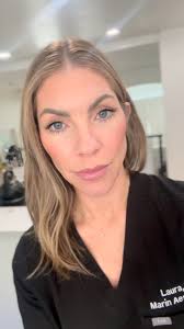 ✨ Microneedling with PRP — the ultimate skin rejuvenation combo! ✨,  Microneedling creates controlled micro-injuries that trigger your skin’s  natural healing response, boosting collagen and elastin for ...