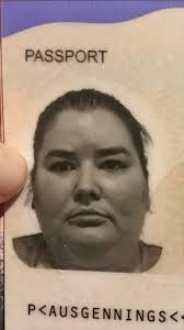 Heya! I had the gastric sleeve surgery done in March 2023