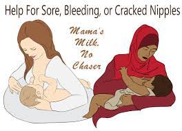Help For Sore, Bleeding, Or Cracked Nipples – Mama's Milk, No Chaser