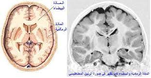 Resultat De Recherche D Images Pour فيديو لساحاث المخ