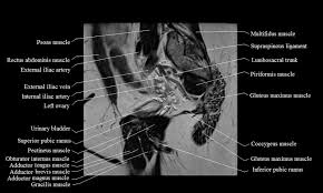 The clavicles, or collarbones, are a pair of long bones that connect the scapula to the sternum. Mri Female Pelvis Anatomy Free Mri Sagittal Cross Sectional Anatomy Of Female Pelvis