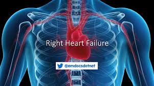 Image result for Right Heart Failure