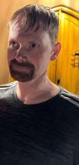 Advice for stroke recovery journey?