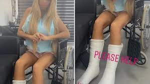 They are always falling off and have to be restuck and because they have been restuck sooooo i'm a dentist and i'm so glad you said that about katie price. Katie Price Shows Off Her Metal Teeth As She Gets Veneers Fitted Daily Mail Online