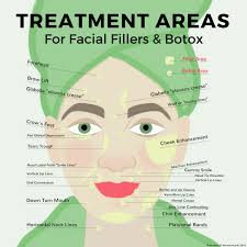 botox diagram catalogue of schemas