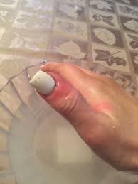 Diabetics and runners are at risk. What Does Nail Melanoma Look Like Skin Cancer Can Hide As Line On Nail