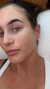 Glowing gut = glowing skin ✨ , It turns out, an unhealthy gut leads to  inflammation and toxin buildup, which can wreak havoc