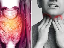 The types of surgical procedures you may consider to treat your throat cancer depend on the location and stage of your cancer. The Throat Cancer Causes Symptoms And Prevention The Preachers Portal