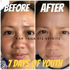 Lemon ini merupakan buah yang dipercaya permen pelega tenggorokan merupakan cara menghilangkan dahak di tenggorokan secara alami. Cara Hilangkan Sunburn Bagi Orang Kuat Main Sukan Bebelsihat Com